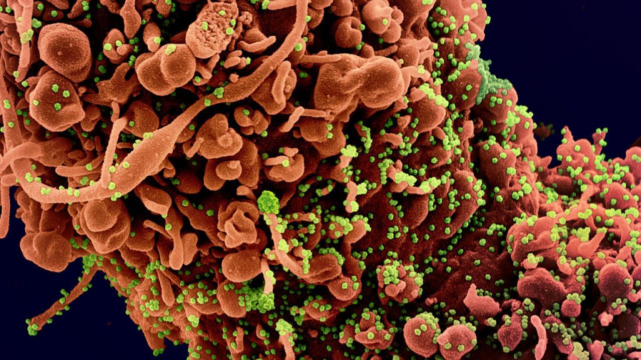 Colorized scanning electron micrograph of a cell 
