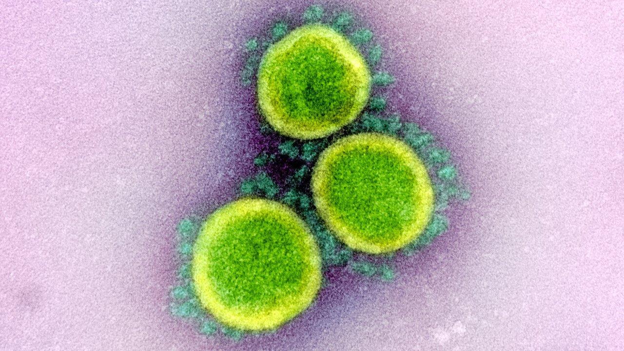 Photo: National Institute of Allergy and Infectious Diseases, National Institute of Health. coronavirus image
